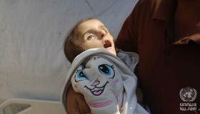 A 4-year-old Palestinian girl, lost her life due to malnutrition and lack of treatment due to the war on Gaza